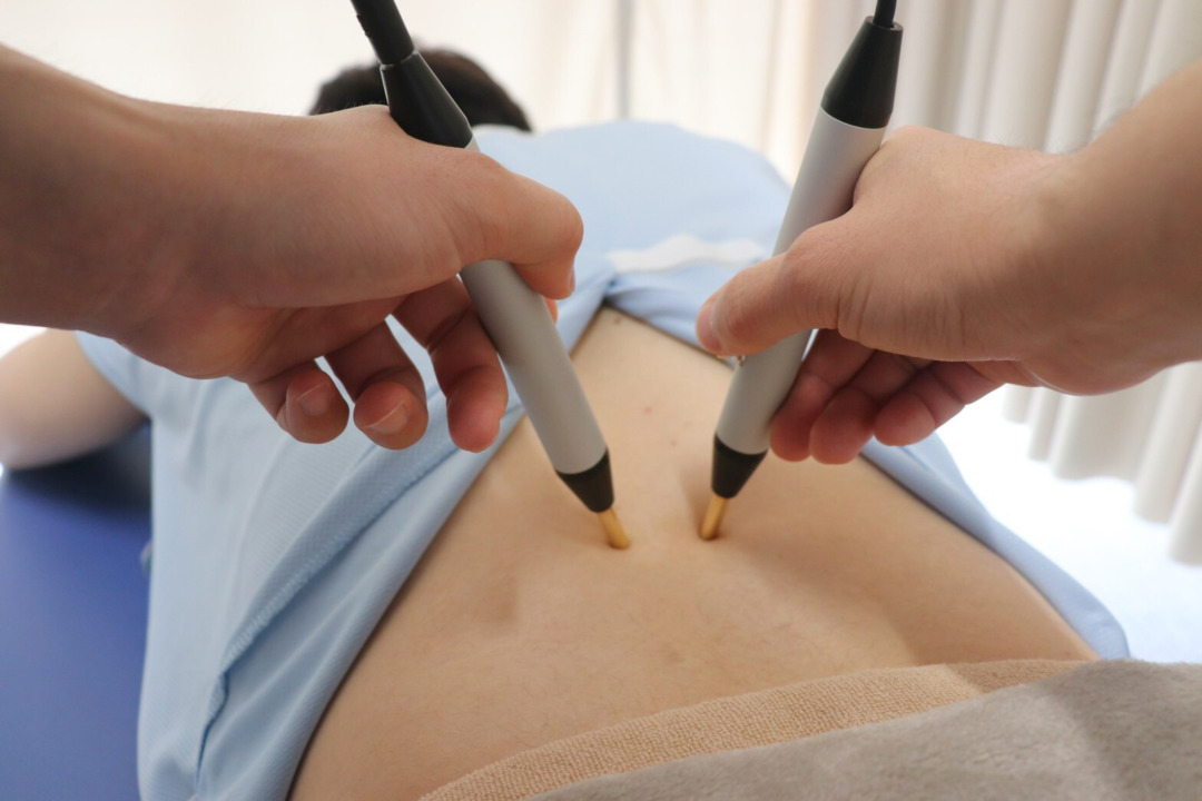 高松市高松町の高松メディアス整骨院でのアキュスコープ施術で背中の痛みを改善