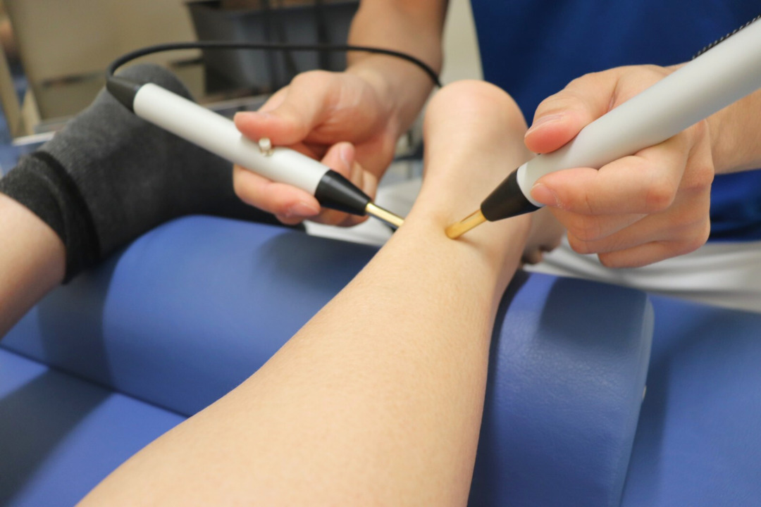 アキレス腱の問題は高松メディアス整骨院のアキュスコープ治療で解決