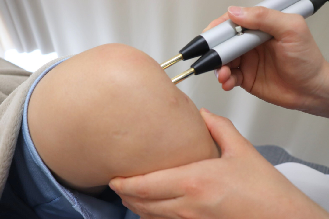 打撲の治療は、高松市高松町の高松メディアス整骨院で