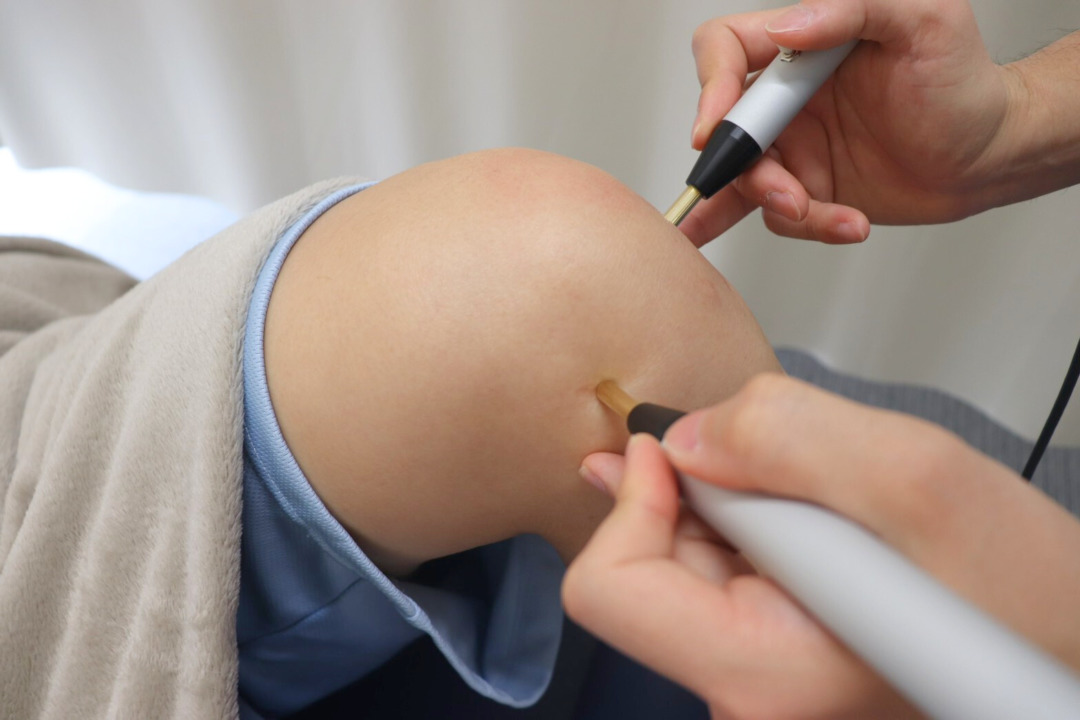 膝の痛みはアキュスープとマイオパルス治療で根本改善